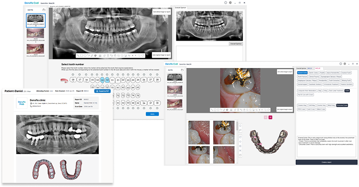/assets/densflo_codi_2.png